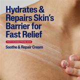 Cetaphil Pro Eczema Prone Soothe & Repair Cream (226g) สำหรับผู้ที่มีปัญหาผิวแห้งมาก ผิวหนังคัน และผิวที่มีแนวโน้มเป็นผื่นแพ้