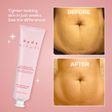 BodyBlendz Anti-Cellulite & Stretch Mark Lotion 150 ml เซลลูไลท์ดูจางลงอย่างเห็นได้ชัด
